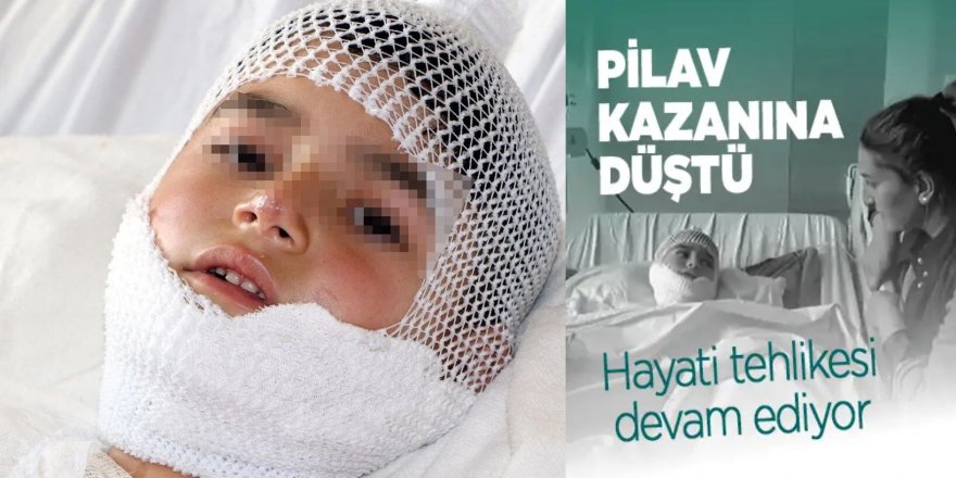 Pilav kazanında yanan Ferid’in hayatta kalma mücadelesi