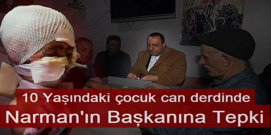 Küçük çocuk sokak köpeklerinin saldırısına uğradı: Narman Belediye Başkanı Okey oynadı