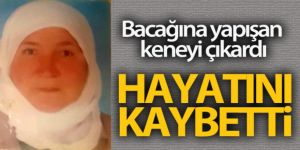 Bacağına yapışan keneyi çıkardı, 1 hafta sonra hayatını kaybetti