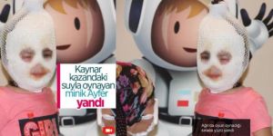 Ağrı'da oyun oynadığı sırada yüzü yandı