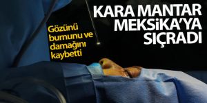 Kara mantar hastalığı Meksika'ya da sıçradı