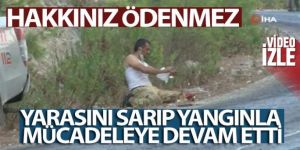 Orman işçisi yarasını sarıp, yangınla mücadeleye devam etti